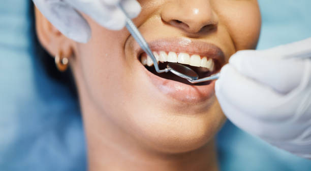 Best Emergency Treatment for Toothache in Jamestown, NY