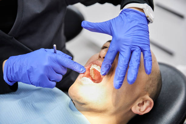 Best Emergency Treatment for Toothache in Jamestown, NY
